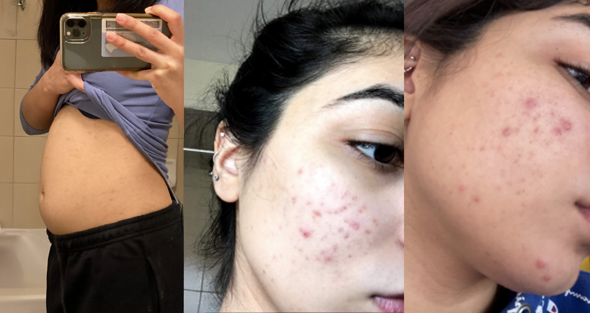 Early Cure Superfoods journey moment